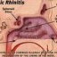 image of allergic rhinitis