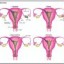 image of menstruation
