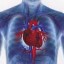image of cardiovascular