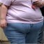 image of obesity