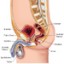 image of prostate