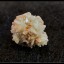 kidney_stone_s1_crystal