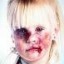 image of abused child 3
