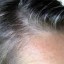 image of grey hair image of grey hair