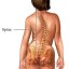 scoliosis image