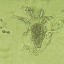 image of chytrid deadly fungus