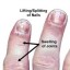 image of nutritional deficiency image of nutritional deficiency