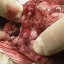 image of cancerous tissue