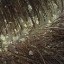 dandruff images
