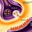 image of parkinson's