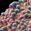 image of cancerous cells