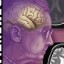 image of dementia