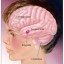 image of autistic brain