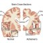 normal brain vs. brain aging