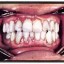 poor dental hygiene