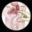 prostate