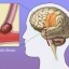 recurrence of a stroke