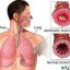 bronchial pneumonia