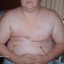 mastectomy
