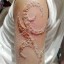 tattoo infection